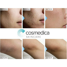 Cargar imagen en el visor de la galería, Cosmedica Exfoliante Facial Con Enzimas Minerales 2oz