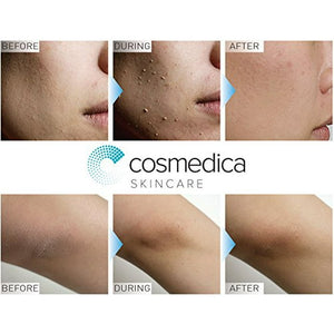 Cosmedica Exfoliante Facial Con Enzimas Minerales 2oz