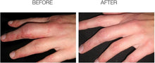 Cargar imagen en el visor de la galería, Scarfade Scar Gel, 15g
