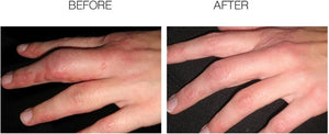 Scarfade Scar Gel, 15g